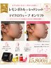 【人気No.2】増量レモンorレッド1ヶ所×マイクロ波