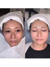 シド/右アフター　左ビフォー