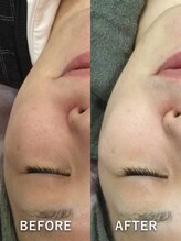 ティースキンサロンオキナワ(T-skin salon Okinawa)/美白叶えます☆