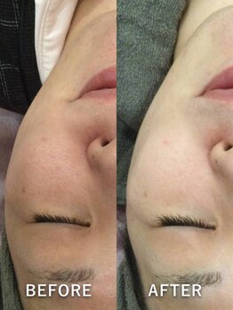 ティースキンサロンオキナワ(T-skin salon Okinawa)/美白叶えます☆