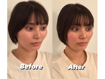 コルミチョン サロン(骨美整 salon)/Before・After &nbsp;1回施術