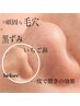 【7月迄限定★】毛穴洗浄全顔コース　7000円→4500円