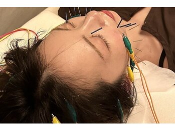 デルタエヌピー63+(δnp63+)/お客様の施術風景【小顔/薬院】