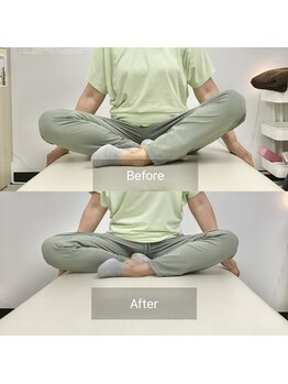 ナオル整体 国分寺院(NAORU整体)/70代女性【膝の痛み・股関節】