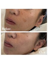 ピュア 川越店/サロンピュアスペシャルコース