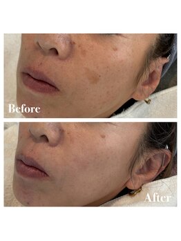 ピュア 川越店/サロンピュアスペシャルコース