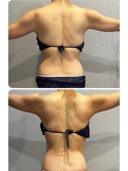 ラヴィエール(Laviere)/【レディース痩身120分】