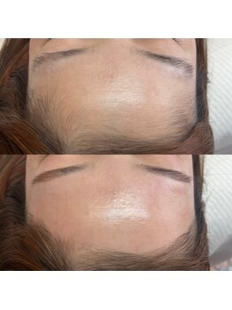 ラティーク 諫早西口店/マリムーブフェイシャルWAX