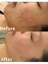 スリリアン 銀座/★お客さまビフォーアフター★