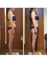 プリンセス バイ セイフティプリンセス 長野店(PRINCESS)/【筋膜リリース3回】