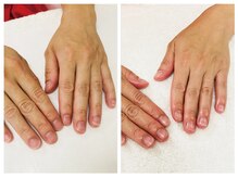 キレイテ 福岡天神店/手の乾燥、むくみにお悩みの方