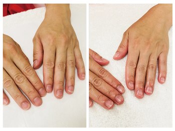 キレイテ 福岡天神店/手の乾燥、むくみにお悩みの方