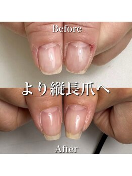 リリー/綺麗な爪もさらに綺麗へ