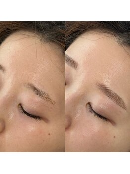 ミィ(mi)/ハリウッドブロウリフト