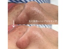 リベルキョウト 京都駅前店(Liber Kyoto)/毛穴レス艶肌コース