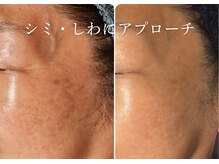 アマランサス(Amaranthus)/くすみを改善し、透明肌へ