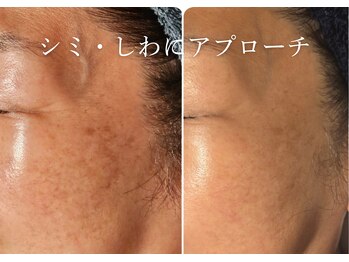 アマランサス(Amaranthus)/くすみを改善し、透明肌へ