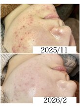 ブラックボックス(BLACK BOX)/20代女性のお客様