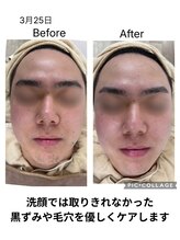 ルポ(Repos)/メンズエステシェービング