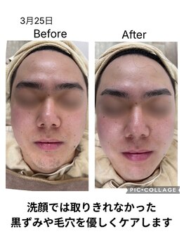 ルポ(Repos)/メンズエステシェービング