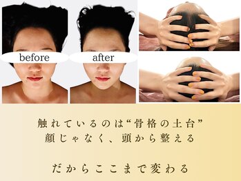 スカイ(sky)/そのたるみ、骨のズレかも。