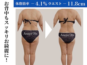 アナパ・オラ/マグニート×6種痩身マシン
