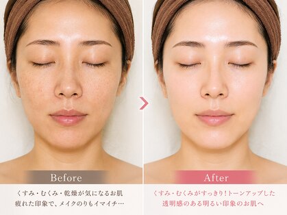 トータルヘルスビューティーカズ(TotalHealthBeauty KAZU)の写真