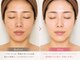 トータルヘルスビューティーカズ(TotalHealthBeauty KAZU)の写真