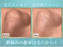 リメイク 広尾(REMAKE)の雰囲気(毛穴ケアは美の基礎管理!徹底的にその日取れる最大限の汚れを☆)