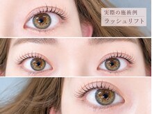 マイアンジェリーク 旭川店の雰囲気（低反発のベッドと足まくらでリラックスしながらの施術です。）