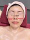 ミッシュ(Mish)の写真/【大気汚染物質や余分な皮脂や角質を取り除く】セルキュア4++美顔器で美肌&フェイスラインのたるみも綺麗に