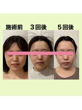 サロンドミジュ(Salon de 美jyu)/小顔・骨格矯正　20代