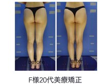 エステージ(estage)/