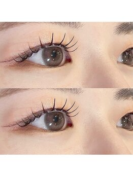 エイルアイ(Aile eye)/フラット140本