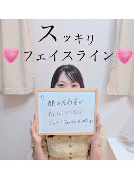 顔凛(カオリン)/お顔スッキリ/たるみ・ゆがみ