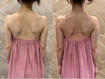 ロココ 豊田店(Rococo)/ビフォーアフター