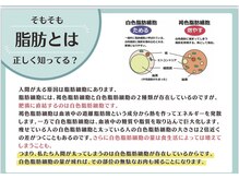 ケアビューティーソラ(care beauty SORA)/脂肪冷却とは