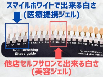 スマイルホワイト 練馬店
