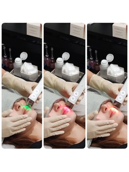 オリス(ORRIS)/たった1回の施術とクリームで♪