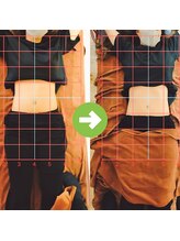 サプライズ整体院/20代ママさんの産後の骨盤矯正