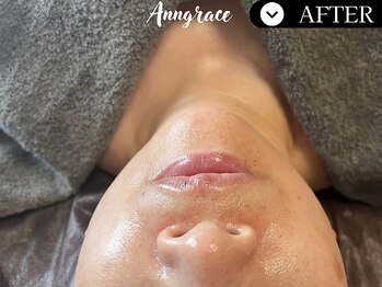 アングレイス(Anngrace)/【ポールシェリー】/After