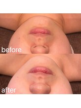 ビュウナ 銀座(BEAUNA)/カルテットモード全顔