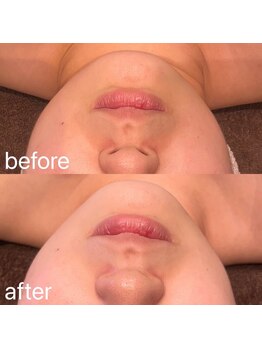 ビュウナ 銀座(BEAUNA)/カルテットモード全顔