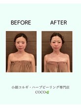 ココ 広島店(COCO)/cocoオリジナル小顔コルギ！