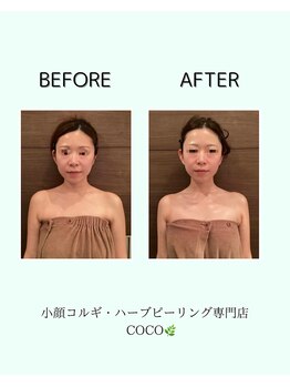 ココ 広島店(COCO)/cocoオリジナル小顔コルギ!