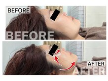 ミヨン ヨコハマ(Miyonne Yokohama)の雰囲気(〈顎下or頬〉の最強小顔レモンボトル/港南台駅/ドライヘッドスパ)