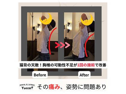 ユッカ(Yucca)の写真