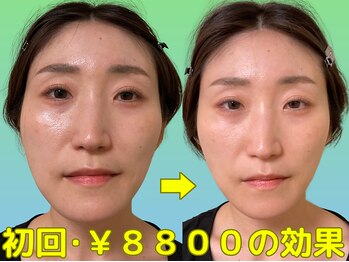 ナチュラルパーフェクトフェイス 新宿/一回で効果を実感/新宿駅小顔