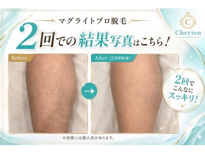 シェリアン バイ アイビー(Cherien by IVY)の写真