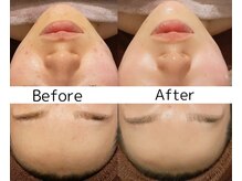 ココモカ(COCOMOKA)/☆REVI陶肌トリートメント☆